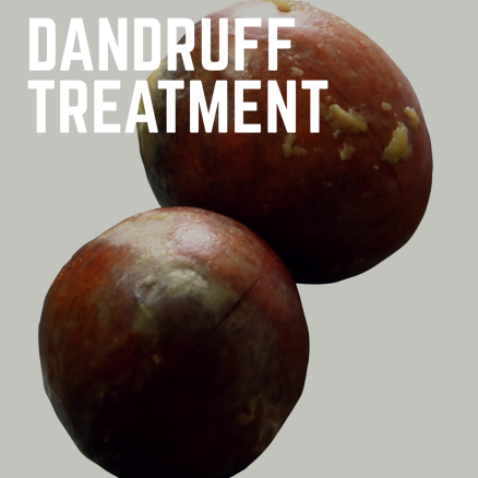 dandruff treatment